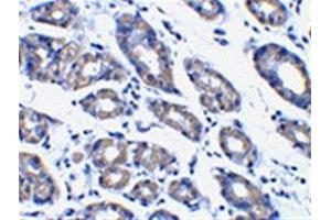 Image no. 2 for anti-Phorbol-12-Myristate-13-Acetate-Induced Protein 1 (PMAIP1) (N-Term) antibody (ABIN318707) (NOXA 抗体  (N-Term))