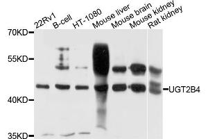 Western blot analysis of extracts of various cell lines, using μgT2B4 antibody (ABIN5972312) at 1/1000 dilution. (UGT2B4 抗体)