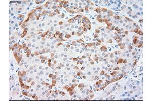 Immunohistochemistry (IHC) image for anti-Keratin 18 (KRT18) (AA 69-372) antibody (ABIN1491638) (Cytokeratin 18 抗体  (AA 69-372))
