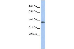 WB Suggested Anti-FOXB1 Antibody Titration:  0. (FOXB1 抗体  (Middle Region))