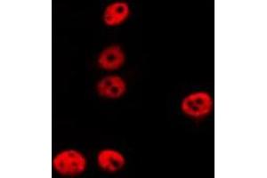ABIN6275223 staining LOVO by IF/ICC. (REC8 抗体  (Internal Region))
