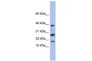WB Suggested Anti-NDUFC1 Antibody Titration: 0. (NDUFC1 抗体  (Middle Region))