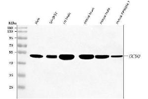 anti-Otoconin 90 (OC90) (AA 18-430) antibody