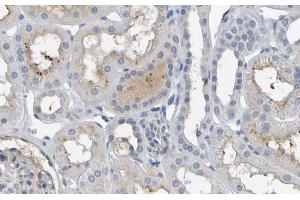 ABIN6277153 at 1/100 staining human kidney tissues  sections by IHC-P. (IL-10 抗体  (Internal Region))