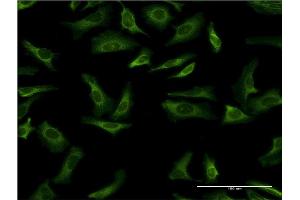 Immunofluorescence of monoclonal antibody to YWHAG on HeLa cell. (14-3-3 gamma 抗体  (AA 1-247))
