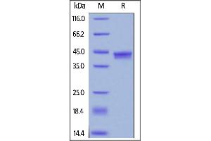 Biotinylated Human IL-17A&IL-17F, Avitag,His Tag on  under reducing (R) condition. (IL-17A/F Protein (AA 24-155) (His tag,AVI tag,Biotin))