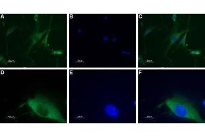 Expression of neuropeptide Y1 receptor in DRG neurons - Immunocytochemical staining of a primary culture of rat dorsal root ganglion (DRG) neurons. (NPY1R 抗体  (AA 237-252))