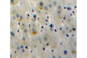 IHC-P analysis of Liver tissue, with DAB staining. (TLR6 抗体  (AA 17-239))