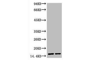 Western blot analysis of Hela, diluted at 1) 1:2000 2) 1:5000 (COX IV 抗体)
