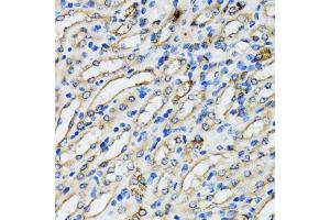 Immunohistochemistry of paraffin-embedded mouse kidney using COPB2 antibody (ABIN5974232) at dilution of 1/100 (40x lens). (COPB2 抗体)