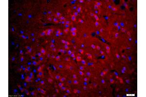 Formalin-fixed and paraffin embedded rat brain labeled with Anti-5HT3A Receptor/SR-3A Polyclonal Antibody, Unconjugated (ABIN1386182) at 1:200 followed by conjugation to the secondary antibody Goat Anti-Rabbit IgG, Cy3 conjugated used at 1:200 dilution for 40 minutes at 37°C and DAPI staining (Serotonin Receptor 3A 抗体  (AA 31-130))