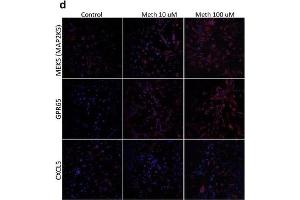 Validation of selected upregulated genes. (CXCL5 抗体  (AA 51-132))