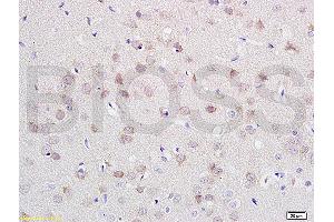 Formalin-fixed and paraffin embedded rat brain labeled with Anti-CDH2/N-cadherin Polyclonal Antibody, Unconjugated (ABIN738726) at 1:200 followed by conjugation to the secondary antibody and DAB staining. (N-Cadherin 抗体  (AA 701-800))
