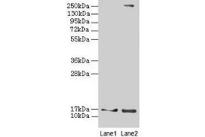 Western blot All lanes: CRABP1 antibody at 4 μg/mL Lane 1: Mouse eye tissue Lane 2: THP-1 whole cell lysate Secondary Goat polyclonal to rabbit IgG at 1/10000 dilution Predicted band size: 16 kDa Observed band size: 16 kDa (CRABP1 抗体  (AA 2-137))