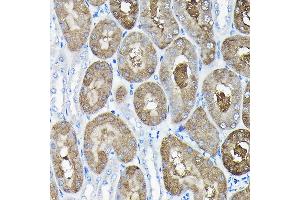 Immunohistochemistry of paraffin-embedded mouse kidney using TCP1 Rabbit pAb (ABIN6130046, ABIN6148956, ABIN6148957 and ABIN6217330) at dilution of 1:100 (40x lens). (TCP1 alpha/CCTA 抗体  (AA 307-556))