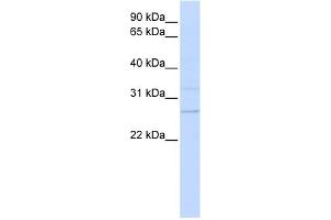WB Suggested Anti-TMEM126B Antibody Titration:  0. (TMEM126B 抗体  (N-Term))
