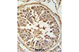 Immunohistochemistry (Paraffin-embedded Sections) (IHC (p)) image for anti-ATP-Binding Cassette, Sub-Family F (GCN20), Member 1 (ABCF1) (AA 694-724), (C-Term) antibody (ABIN950207)