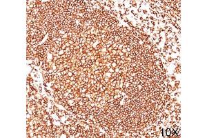 IHC testing of human tonsil (10X) stained with CD45 antibody cocktail (2B11 + PD7/26). (CD45 抗体)