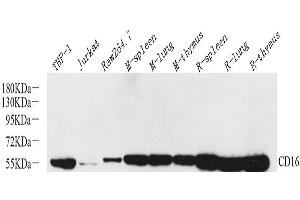 Western Blot analysis of various samples using FCGR3A Polyclonal Antibody at dilution of 1:800. (FCGR3A 抗体)