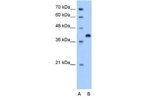 TOR2A antibody used at 1. (TOR2A 抗体  (N-Term))