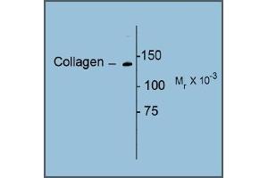 Image no. 1 for anti-Collagen, Type I (COL1) antibody (ABIN372600) (Collagen Type I 抗体)
