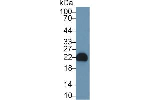 Detection of FGF12 in Rat Cerebrum lysate using Polyclonal Antibody to Fibroblast Growth Factor 12 (FGF12) (FGF12 抗体  (AA 1-181))