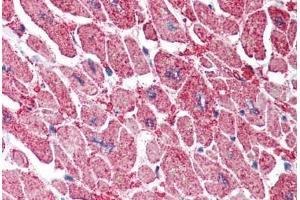 Human Heart (formalin-fixed, paraffin-embedded) stained with KPNA3 antibody ABIN337019 at 5 ug/ml followed by biotinylated anti-goat IgG secondary antibody ABIN481715, alkaline phosphatase-streptavidin and chromogen. (KPNA3 抗体  (AA 509-521))