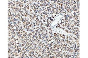 IHC analysis of TRK fused gene/TFG using anti-TRK fused gene/TFG antibody (ABIN7599839). (TFG 抗体  (AA 121-400))