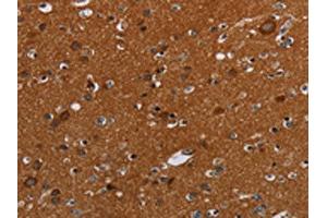 The image on the left is immunohistochemistry of paraffin-embedded Human brain tissue using ABIN7192423(SLC22A12 Antibody) at dilution 1/20, on the right is treated with synthetic peptide. (SLC22A12 抗体)