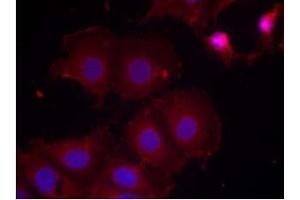 Image no. 2 for anti-Receptor tyrosine-protein kinase erbB-2 (ErbB2/Her2) (pTyr877) antibody (ABIN196748) (ErbB2/Her2 抗体  (pTyr877))