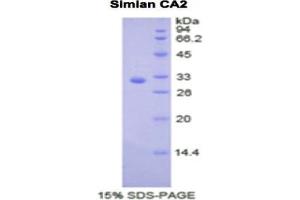 SDS-PAGE analysis of Monkey Carbonic Anhydrase II Protein. (CA2 蛋白)