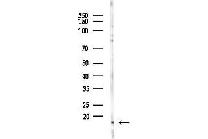 Western blot analysis of lysates from COLO205 cells(heat-shock,45 min treatment), using DNAJC19 Antibody at 1/1000 dilution.