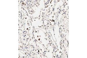 Immunohistochemical analysis of paraffin-embedded human lung tissue using B performed on the Leica® BOND RXm. (Slc6a14 抗体  (C-Term))