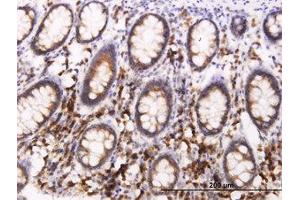 Image no. 3 for anti-B-Cell Receptor-Associated Protein 29 (BCAP29) (AA 125-241) antibody (ABIN599278) (BCAP29 抗体  (AA 125-241))