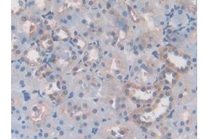 DAB staining on IHC-P; Samples: Rat Kidney Tissue (Laminin beta 3 抗体  (AA 503-738))