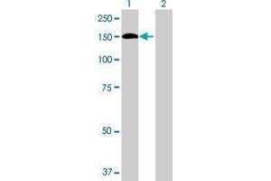 Lane 1: ALPK1 transfected lysate ( 119. (ALPK1 293T Cell Transient Overexpression Lysate(Denatured))