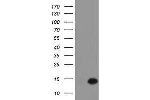 Western Blotting (WB) image for anti-Chromosome 17 Open Reading Frame 37 (C17orf37) antibody (ABIN1501784) (C17orf37 抗体)