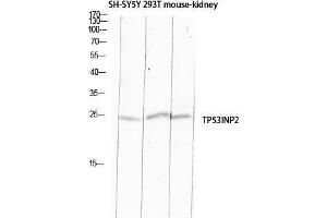 Western Blot (WB) analysis of SH-SY5Y 293T Mouse Kidney lysis using TP53INP2 antibody. (TP53INP2 抗体)