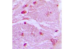 Immunohistochemical analysis of CSRP1 staining in human brain formalin fixed paraffin embedded tissue section. (CSRP1 抗体  (Center))