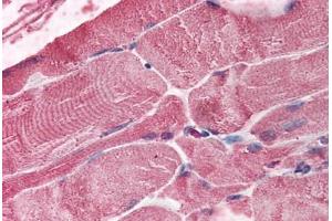 Human Skeletal Muscle (formalin-fixed, paraffin-embedded) stained with BMI1 antibody ABIN292553 at 2. (BMI1 抗体  (AA 252-264))