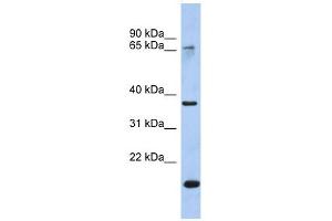 Annexin A10 antibody used at 1 ug/ml to detect target protein. (Annexin a10 抗体  (Middle Region))