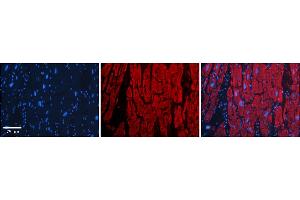 Rabbit Anti-OTUD7B Antibody    Formalin Fixed Paraffin Embedded Tissue: Human Adult heart  Observed Staining: Cytoplasmic Primary Antibody Concentration: 1:600 Secondary Antibody: Donkey anti-Rabbit-Cy2/3 Secondary Antibody Concentration: 1:200 Magnification: 20X Exposure Time: 0. (OTUD7B 抗体  (Middle Region))