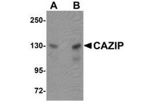Western blot analysis of CAZIP in A20 cell lysate with AP30208PU-N CAZIP antibody at (A) 0. (CAZIP 抗体  (C-Term))