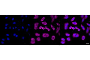 Immunocytochemical staining of HepG2 cells with AGR2 antibody (ABIN7797627), 1:1,000). (Recombinant AGR2 抗体)