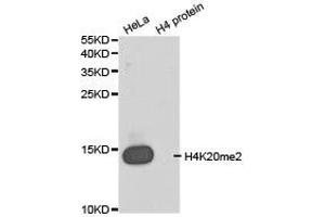 Western blot analysis of extracts of HeLa cell line and H4 protein expressed in E. (Histone 3 抗体  (2meLys20))