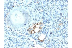 Formalin-fixed, paraffin-embedded human Spleen stained with TRAcP Rabbit Recombinant Monoclonal Antibody (ACP5/2336R). (Recombinant ACP5 抗体)