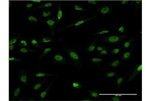 Immunofluorescence (IF) image for anti-LIM Domain Only 4 (LMO4) (AA 1-165) antibody (ABIN521987)