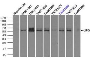 Image no. 1 for anti-Lipase, Endothelial (LIPG) antibody (ABIN1499169) (LIPG 抗体)