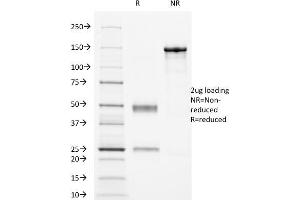 SDS-PAGE Analysis Purified CD16 Mouse Monoclonal Antibody (HuNK2). (FCGR3A 抗体)