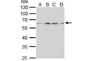 WB Image FGFR-5 antibody detects FGFR-5 protein by Western blot analysis. (FGFRL1 抗体)